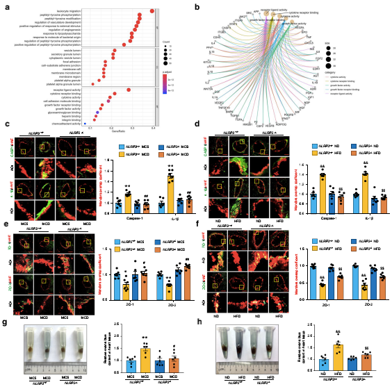 NLRP3炎癥小體介導(dǎo)NAFLD小鼠冠狀動(dòng)脈微血管內(nèi)皮高通透性